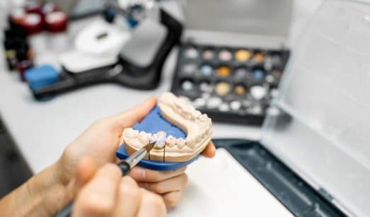 האם שתלים למחוסרי עצם מחזיקים לאורך זמן כמו שתלים רגילים